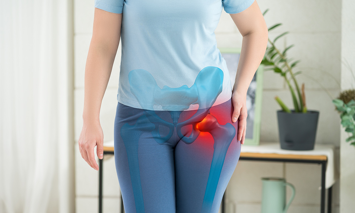 Kalça Sıkışma Sendromu Tedavisi